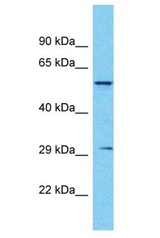 ASMT / HIOMT Antibody - ASMT / HIOMT antibody Western Blot of Fetal Kidney. Antibody dilution: 1 ug/ml.  This image was taken for the unconjugated form of this product. Other forms have not been tested.