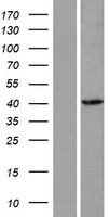 ASMT / HIOMT Protein - Western validation with an anti-DDK antibody * L: Control HEK293 lysate R: Over-expression lysate