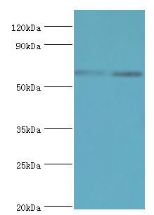 ASMTL Antibody - Western blot. All lanes: N-acetylserotonin O-methyltransferase-like protein antibody at 2 ug/ml. Lane 1: HeLa whole cell lysate. Lane 2: A549 whole cell lysate. Secondary antibody: Goat polyclonal to rabbit at 1:10000 dilution. Predicted band size: 69 kDa. Observed band size: 69 kDa.