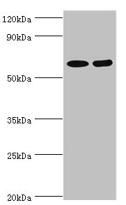 ASMTL Antibody - Western blot All lanes: N-acetylserotonin O-methyltransferase-like protein antibody at 2µg/ml Lane 1: Hela whole cell lysate Lane 2: A549 whole cell lysate Secondary Goat polyclonal to rabbit IgG at 1/10000 dilution Predicted band size: 69, 68, 63 kDa Observed band size: 69 kDa