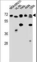 ASMTL Antibody - ASMTL Antibody western blot of MDA-MB231,HL-60,HeLa,A549,CEM cell line lysates (35 ug/lane). The ASMTL antibody detected the ASMTL protein (arrow).