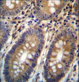 ASMTL Antibody - ASMTL Antibody immunohistochemistry of formalin-fixed and paraffin-embedded human colon tissue followed by peroxidase-conjugated secondary antibody and DAB staining.
