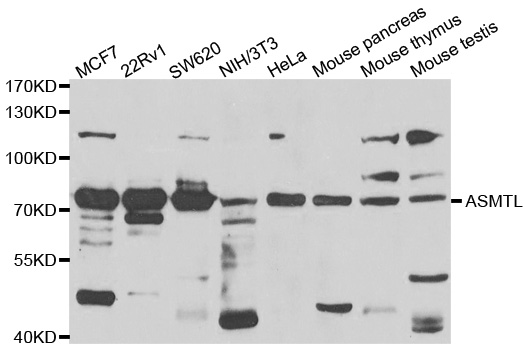 ASMTL Antibody - Western blot analysis of extracts of various cell lines.