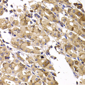 ASMTL Antibody - Immunohistochemistry of paraffin-embedded human gastric injury tissue.