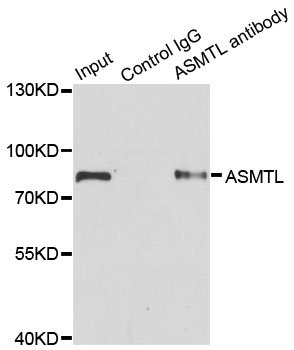 ASMTL Antibody - Immunoprecipitation analysis of 200ug extracts of SW620 cells.