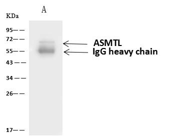 ASMTL Antibody - ASMTL was immunoprecipitated using: Lane A: 0.5 mg HL-60 Whole Cell Lysate. 4 uL anti-ASMTL rabbit polyclonal antibody and 60 ug of Immunomagnetic beads Protein A/G. Primary antibody: Anti-ASMTL rabbit polyclonal antibody, at 1:100 dilution. Secondary antibody: Goat Anti-Rabbit IgG (H+L)/HRP at 1/10000 dilution. Developed using the ECL technique. Performed under reducing conditions. Predicted band size: 69 kDa. Observed band size: 69 kDa.