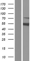 ASMTL Protein - Western validation with an anti-DDK antibody * L: Control HEK293 lysate R: Over-expression lysate