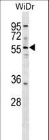 ASNS Antibody - ASNS Antibody western blot of WiDr cell line lysates (35 ug/lane). The ASNS antibody detected the ASNS protein (arrow).