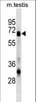 ASNS Antibody - ASNS Antibody western blot of mouse testis tissue lysates (35 ug/lane). The ASNS antibody detected the ASNS protein (arrow).