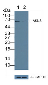 ASNS Antibody - Knockout Varification: Lane 1: Wild-type K562 cell lysate; Lane 2: ASNS knockout K562 cell lysate; Predicted MW: 64,62,54kd Observed MW: 62kd Primary Ab: 3µg/ml Rabbit Anti-Human ASNS Antibody Second Ab: 0.2µg/mL HRP-Linked Caprine Anti-Rabbit IgG Polyclonal Antibody