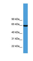 ASNS Antibody - ASNS antibody Western blot of Fetal lung lysate.  This image was taken for the unconjugated form of this product. Other forms have not been tested.