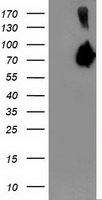 ASNS Antibody - HEK293T cells were transfected with the pCMV6-ENTRY control (Left lane) or pCMV6-ENTRY ASNS (Right lane) cDNA for 48 hrs and lysed. Equivalent amounts of cell lysates (5 ug per lane) were separated by SDS-PAGE and immunoblotted with anti-ASNS.