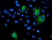 ASNS Antibody - Anti-ASNS mouse monoclonal antibody immunofluorescent staining of COS7 cells transiently transfected by pCMV6-ENTRY ASNS.