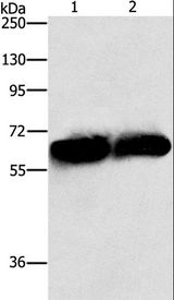 ASNS Antibody - Western blot analysis of Lovo and 231 cell, using ASNS Polyclonal Antibody at dilution of 1:1000.