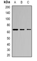 ASNS Antibody - Western blot analysis of Asparagine Synthetase expression in MCF7 (A); K562 (B); mouse testis (C) whole cell lysates.