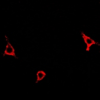 ASNS Antibody - Immunofluorescent analysis of Asparagine Synthetase staining in A549 cells. Formalin-fixed cells were permeabilized with 0.1% Triton X-100 in TBS for 5-10 minutes and blocked with 3% BSA-PBS for 30 minutes at room temperature. Cells were probed with the primary antibody in 3% BSA-PBS and incubated overnight at 4 deg C in a humidified chamber. Cells were washed with PBST and incubated with a DyLight 594-conjugated secondary antibody (red) in PBS at room temperature in the dark.