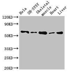 ASNS Antibody - Western Blot Positive WB detected in:Hela whole cell lysate,SH-SY5Y whole cell lysate,Mouse skeletal muscle tissue,Rat heart tissue,Rat liver tissue All Lanes:ASNS antibody at 2.7µg/ml Secondary Goat polyclonal to rabbit IgG at 1/50000 dilution Predicted band size: 65,63,55 KDa Observed band size: 65 KDa