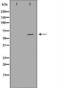 ASNS Antibody - Western blot analysis of K562 whole cells lysates using ASNS antibody. The lane on the left is treated with the antigen-specific peptide.