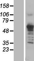 ASNS Protein - Western validation with an anti-DDK antibody * L: Control HEK293 lysate R: Over-expression lysate