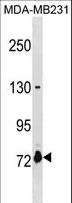 ASNSD1 Antibody - ASNSD1 Antibody western blot of MDA-MB231 cell line lysates (35 ug/lane). The ASNSD1 antibody detected the ASNSD1 protein (arrow).