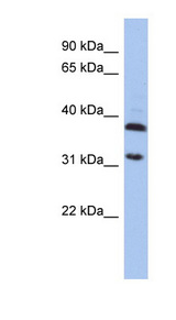 ASPA Antibody - ASPA antibody Western blot of HepG2 cell lysate. This image was taken for the unconjugated form of this product. Other forms have not been tested.