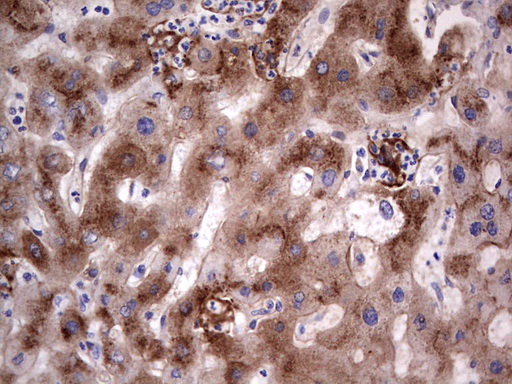 ASPA Antibody - IHC of paraffin-embedded Human liver tissue using anti-ASPA mouse monoclonal antibody. (Heat-induced epitope retrieval by 1 mM EDTA in 10mM Tris, pH8.5, 120°C for 3min).
