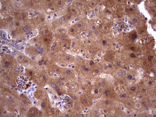 ASPA Antibody - Immunohistochemical staining of paraffin-embedded Human liver tissue within the normal limits using anti-ASPA mouse monoclonal antibody. (Heat-induced epitope retrieval by 1 mM EDTA in 10mM Tris, pH8.5, 120C for 3min,