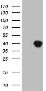 ASPA Antibody - HEK293T cells were transfected with the pCMV6-ENTRY control. (Left lane) or pCMV6-ENTRY ASPA. (Right lane) cDNA for 48 hrs and lysed. Equivalent amounts of cell lysates. (5 ug per lane) were separated by SDS-PAGE and immunoblotted with anti-ASPA. (1:2000)