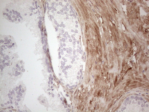 ASPA Antibody - Immunohistochemical staining of paraffin-embedded Human prostate tissue within the normal limits using anti-ASPA mouse monoclonal antibody. (Heat-induced epitope retrieval by 1mM EDTA in 10mM Tris buffer. (pH8.5) at 120°C for 3 min. (1:150)