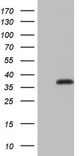 ASPA Antibody - HEK293T cells were transfected with the pCMV6-ENTRY control. (Left lane) or pCMV6-ENTRY ASPA. (Right lane) cDNA for 48 hrs and lysed. Equivalent amounts of cell lysates. (5 ug per lane) were separated by SDS-PAGE and immunoblotted with anti-ASPA.