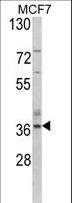 ASPA Antibody - Western blot of ASPA Antibody in MCF7 cell line lysates (35 ug/lane). ASPA (arrow) was detected using the purified antibody.