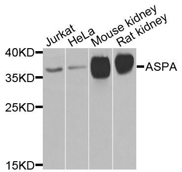 ASPA Antibody - Western blot analysis of extracts of various cells.