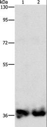 ASPA Antibody - Western blot analysis of Mouse kidney and human fetal kidney tissue, using ASPA Polyclonal Antibody at dilution of 1:1400.