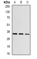 ASPA Antibody - Western blot analysis of Aspartoacylase expression in HeLa (A); mouse kidney (B); rat kidney (C) whole cell lysates.