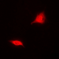 ASPA Antibody - Immunofluorescent analysis of Aspartoacylase staining in MCF7 cells. Formalin-fixed cells were permeabilized with 0.1% Triton X-100 in TBS for 5-10 minutes and blocked with 3% BSA-PBS for 30 minutes at room temperature. Cells were probed with the primary antibody in 3% BSA-PBS and incubated overnight at 4 deg C in a humidified chamber. Cells were washed with PBST and incubated with a DyLight 594-conjugated secondary antibody (red) in PBS at room temperature in the dark.
