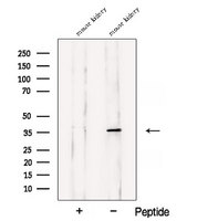 ASPA Antibody - Western blot analysis of extracts of mouse kidney tissue using ASPA antibody. The lane on the left was treated with blocking peptide.