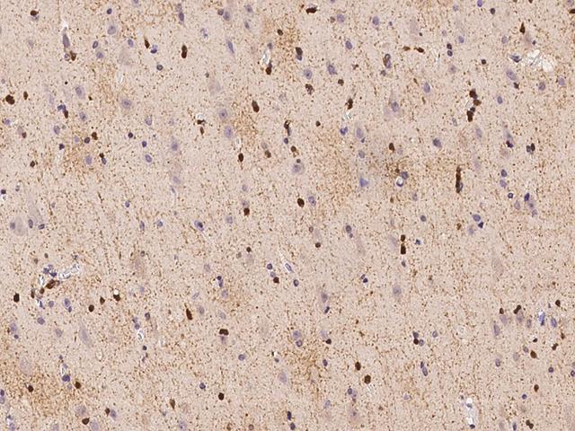 ASPA Antibody - Immunochemical staining of human ASPA in human brain with rabbit polyclonal antibody at 1:100 dilution, formalin-fixed paraffin embedded sections.