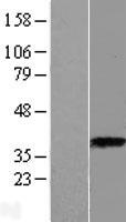 ASPA Protein - Western validation with an anti-DDK antibody * L: Control HEK293 lysate R: Over-expression lysate