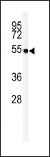 Aspartate Aminotransferase Antibody - Western blot of GOT1 Antibody in mouse liver tissue lysates (35 ug/lane). GOT1 (arrow) was detected using the purified antibody.