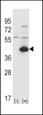 Aspartate Aminotransferase Antibody - Western blot of GOT1 (arrow) using rabbit polyclonal GOT1 Antibody. 293 cell lysates (2 ug/lane) either nontransfected (Lane 1) or transiently transfected (Lane 2) with the GOT1 gene.