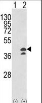 Aspartate Aminotransferase Antibody - Western blot of GOT1 (arrow) using rabbit polyclonal GOT1 Antibody. 293 cell lysates (2 ug/lane) either nontransfected (Lane 1) or transiently transfected with the GOT1 gene (Lane 2).