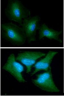 Aspartate Aminotransferase Antibody - ICC/IF analysis of GOT1 in A549 cells line, stained with DAPI (Blue) for nucleus staining and monoclonal anti-human GOT1 antibody (1:100) with goat anti-mouse IgG-Alexa fluor 488 conjugate (Green).ICC/IF analysis of GOT1 in HeLa cells line, stained with DAPI (Blue) for nucleus staining and monoclonal anti-human GOT1 antibody (1:100) with goat anti-mouse IgG-Alexa fluor 488 conjugate (Green).