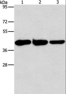 Aspartate Aminotransferase Antibody - Western blot analysis of Human normal liver tissue, mouse brain and heart tissue, using GOT1 Polyclonal Antibody at dilution of 1:1600.