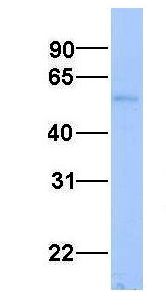 Aspartate Aminotransferase Antibody - Aspartate Aminotransferase antibody Western Blot of Human Fetal Liver . Antibody dilution: 1 ug/ml.  This image was taken for the unconjugated form of this product. Other forms have not been tested.