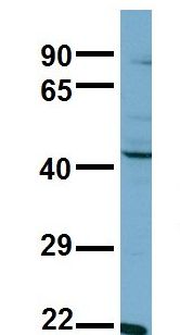 Aspartate Aminotransferase Antibody - Aspartate Aminotransferase antibody Western Blot of NCI-H226 . Antibody dilution: 1 ug/ml.  This image was taken for the unconjugated form of this product. Other forms have not been tested.
