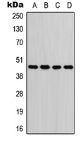 Aspartate Aminotransferase Antibody - Western blot analysis of GOT1 expression in Jurkat (A); A549 (B); PC12 (C); H9C2 (D) whole cell lysates.