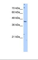 Aspartate Aminotransferase Antibody - HepG2 cell lysate. Antibody concentration: 5.0 ug/ml. Gel concentration: 12%.  This image was taken for the unconjugated form of this product. Other forms have not been tested.