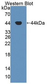 Aspartate Aminotransferase Antibody - Western Blot; Sample: Recombinant protein.