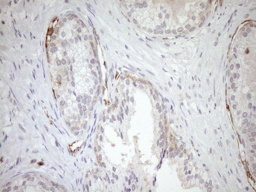 ASPDH Antibody - Immunohistochemical staining of paraffin-embedded Human prostate tissue within the normal limits using anti-ASPDH mouse monoclonal antibody. (Heat-induced epitope retrieval by 1mM EDTA in 10mM Tris buffer. (pH8.5) at 120°C for 3 min. (1:150)