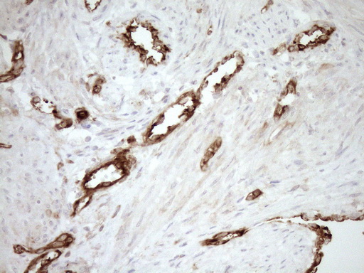 ASPDH Antibody - Immunohistochemical staining of paraffin-embedded Human endometrium tissue within the normal limits using anti-ASPDH mouse monoclonal antibody. (Heat-induced epitope retrieval by 1mM EDTA in 10mM Tris buffer. (pH8.5) at 120°C for 3 min. (1:150)